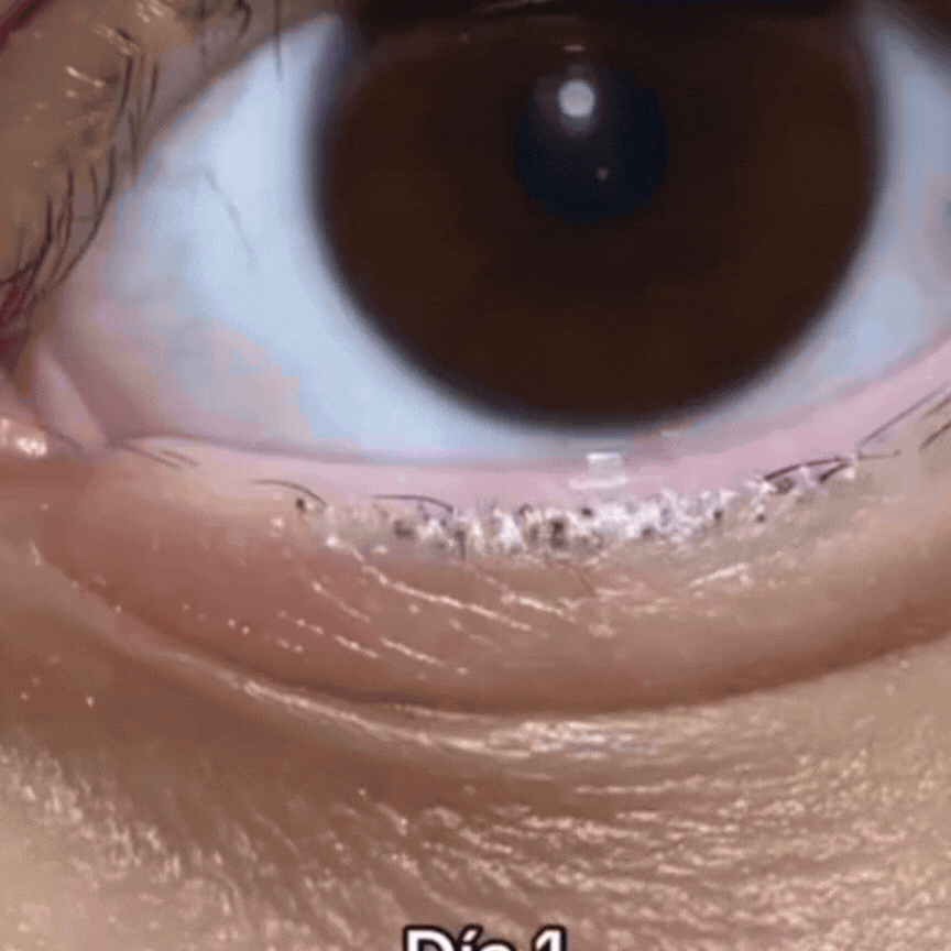 LashGlow-SUERO PARA CRECIMIENTO DE PESTAÑAS